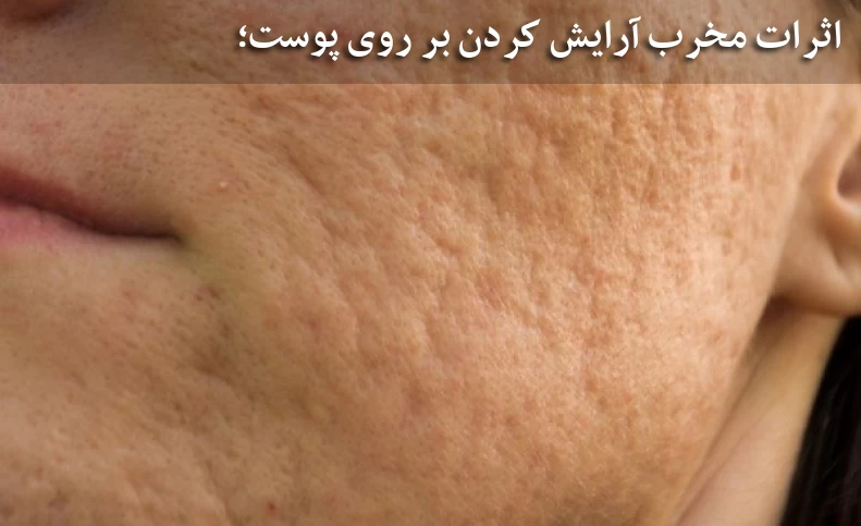 اثرات مخرب آرایش کردن بر روی پوست / آرایش کردن چه عوارضی برای پوست صورت دارد؟